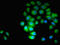 Parvin Alpha antibody, orb400368, Biorbyt, Immunofluorescence image 