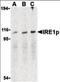 Endoplasmic Reticulum To Nucleus Signaling 1 antibody, orb96314, Biorbyt, Western Blot image 