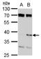 SET Nuclear Proto-Oncogene antibody, TA308954, Origene, Western Blot image 