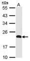 Chemokine-like factor superfamily member 5 antibody, PA5-21937, Invitrogen Antibodies, Western Blot image 