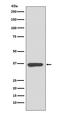 Annexin A10 antibody, M13560, Boster Biological Technology, Western Blot image 