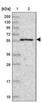 Cleavage And Polyadenylation Specific Factor 7 antibody, PA5-59423, Invitrogen Antibodies, Western Blot image 