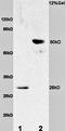 TIMP Metallopeptidase Inhibitor 1 antibody, orb100174, Biorbyt, Western Blot image 