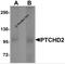 Dispatched RND Transporter Family Member 3 antibody, 6637, ProSci, Western Blot image 