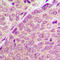 P21 (RAC1) Activated Kinase 1 antibody, abx133156, Abbexa, Western Blot image 