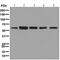 Malic Enzyme 2 antibody, ab126616, Abcam, Western Blot image 