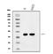 ELOVL Fatty Acid Elongase 4 antibody, A03840-1, Boster Biological Technology, Western Blot image 