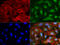 Gamma-Butyrobetaine Hydroxylase 1 antibody, LS-C799962, Lifespan Biosciences, Immunofluorescence image 
