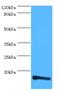 Transmembrane Protein 14B antibody, MBS1489250, MyBioSource, Western Blot image 