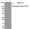 BRCA1 DNA Repair Associated antibody, 79-897, ProSci, Western Blot image 