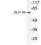 Lymphocyte Cytosolic Protein 2 antibody, LS-C177790, Lifespan Biosciences, Western Blot image 