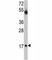 Ubiquitin Conjugating Enzyme E2 V1 antibody, F40115-0.4ML, NSJ Bioreagents, Western Blot image 