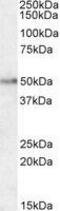 Hypocretin Receptor 2 antibody, GTX88939, GeneTex, Western Blot image 