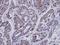 Inositol Polyphosphate-1-Phosphatase antibody, NBP1-31475, Novus Biologicals, Immunohistochemistry frozen image 