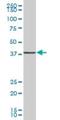 Ubiquitin Like Domain Containing CTD Phosphatase 1 antibody, H00134510-B01P, Novus Biologicals, Western Blot image 