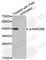 Mitogen-Activated Protein Kinase Kinase 6 antibody, AP0393, ABclonal Technology, Western Blot image 