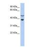 Suppressor Of Cytokine Signaling 7 antibody, NBP1-58902, Novus Biologicals, Western Blot image 