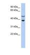 NAP-4 antibody, NBP1-58902, Novus Biologicals, Western Blot image 