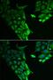 Hyaluronan Binding Protein 2 antibody, PA5-77064, Invitrogen Antibodies, Immunofluorescence image 