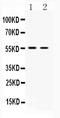 Solute Carrier Family 18 Member A3 antibody, A04891, Boster Biological Technology, Western Blot image 