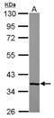 Complement Factor H Related 1 antibody, NBP2-15868, Novus Biologicals, Western Blot image 