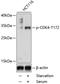 Cyclin Dependent Kinase 4 antibody, A00159T172, Boster Biological Technology, Western Blot image 