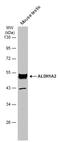 Aldehyde Dehydrogenase 1 Family Member A2 antibody, GTX115148, GeneTex, Western Blot image 