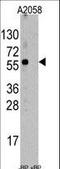 ST13 Hsp70 Interacting Protein antibody, LS-C100494, Lifespan Biosciences, Western Blot image 