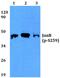 JunB Proto-Oncogene, AP-1 Transcription Factor Subunit antibody, PA5-36659, Invitrogen Antibodies, Western Blot image 