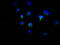 Tyrosinase antibody, CSB-RA567167A0HU, Cusabio, Immunofluorescence image 