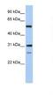 Inosine Monophosphate Dehydrogenase 1 antibody, NBP1-52933, Novus Biologicals, Western Blot image 