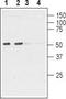Cholinergic Receptor Nicotinic Alpha 6 Subunit antibody, TA328884, Origene, Western Blot image 