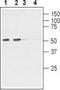 Cholinergic Receptor Nicotinic Alpha 6 Subunit antibody, TA328884, Origene, Western Blot image 