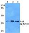EPH Receptor A3 antibody, A02872Y602, Boster Biological Technology, Western Blot image 