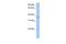 Acid Phosphatase 4 antibody, GTX45911, GeneTex, Western Blot image 