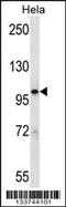 Signal Transducer And Activator Of Transcription 2 antibody, 57-243, ProSci, Western Blot image 