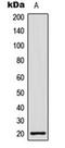 H1 Histone Family Member 0 antibody, orb216122, Biorbyt, Western Blot image 