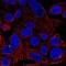 Autophagy Related 9A antibody, NBP2-32477, Novus Biologicals, Immunofluorescence image 