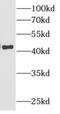 Alport Syndrome, Mental Retardation, Midface Hypoplasia And Elliptocytosis Chromosomal Region Gene 1 antibody, FNab00364, FineTest, Western Blot image 