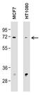 Matrix Metallopeptidase 2 antibody, GTX15772, GeneTex, Western Blot image 