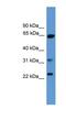 Clathrin light chain A antibody, NBP1-69194, Novus Biologicals, Western Blot image 