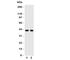 C-X-C Motif Chemokine Receptor 5 antibody, R31129, NSJ Bioreagents, Western Blot image 