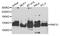 Ring Finger Protein 31 antibody, STJ110526, St John