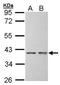 Small Glutamine Rich Tetratricopeptide Repeat Containing Alpha antibody, orb73477, Biorbyt, Western Blot image 