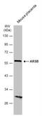 Arylsulfatase B antibody, NBP2-15474, Novus Biologicals, Western Blot image 