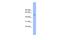 Transmembrane And Coiled-Coil Domains 6 antibody, A16623, Boster Biological Technology, Western Blot image 