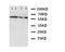 Calcium/Calmodulin Dependent Protein Kinase Kinase 2 antibody, LS-C312652, Lifespan Biosciences, Western Blot image 