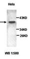 Catenin Alpha 2 antibody, orb77051, Biorbyt, Western Blot image 