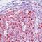 DNA Topoisomerase II Alpha antibody, MA5-12433, Invitrogen Antibodies, Immunohistochemistry paraffin image 