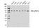 PAT1 Homolog 1, Processing Body MRNA Decay Factor antibody, 14288S, Cell Signaling Technology, Western Blot image 